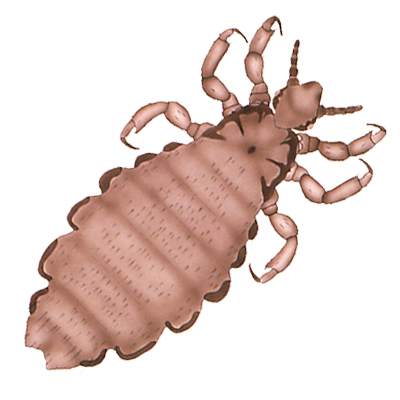 Head Lice